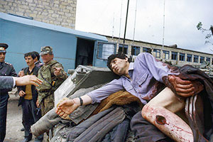 раненый армянский милиционер